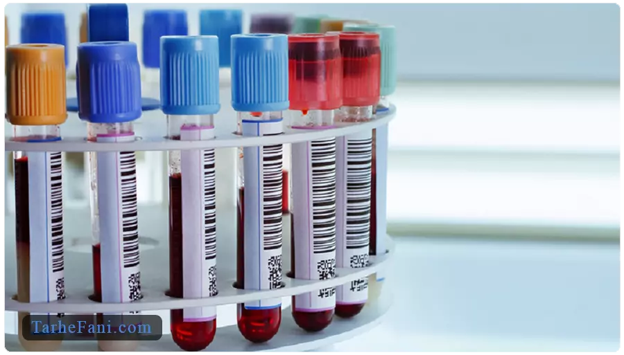 طرح توجیهی کیت های آزمایشگاهی - طرح فنی